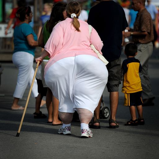 l'obesità aumenta il rischio di dimenza