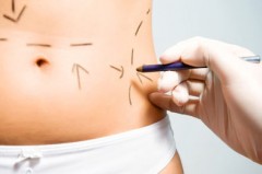 Liposuzione: il grasso ritorna