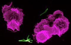 Tbc: paura tra tirocinanti, 25 casi