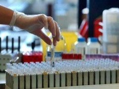 Tumore prostata: il test annuale è inutile