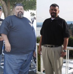bypass-gastrico-alcol bypass gastrico bere alcol
