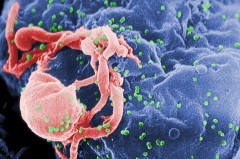 Hiv: un italiano su 4 non sa di essere malato