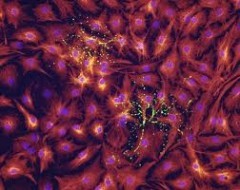 ulcere-venose Ulcere venose: ci sono nuovi metodi di cura