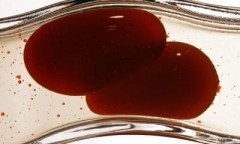 Trombosi venosa profonda e arteriosa: terapia e farmaci utili