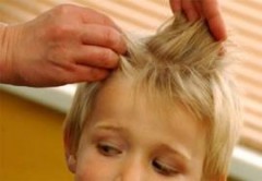 pidocchi Pidocchi: sintomi pediculosi, cause e farmaci efficaci