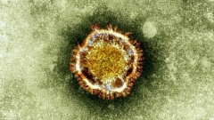 sars-2013-coronavirus Sars 2013: Italia ultime notizie contagio Firenze