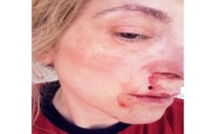 Il cantate Massimo Di Cataldo nei guai: picchia la fidanzata? Foto choc