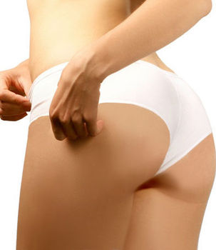 Cellulite cause e rimedi