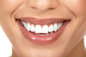 Come avere un bel sorriso, l'importanza dell'igiene orale