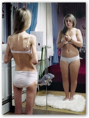 Anoressia, legge sul trattamento sanitario obbligatorio