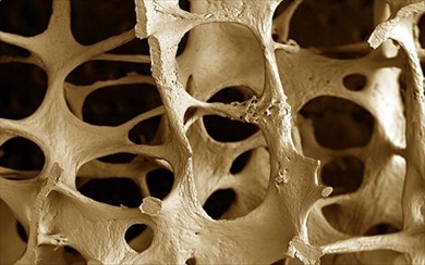 Stop alle fratture, l'osteoporosi non va in vacanza