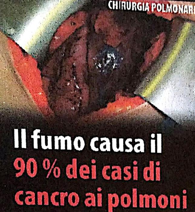 Fumo: su pacchetti frasi e immagini forti per dissuadere