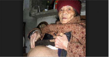 Donna di 93 anni: “Sono incinta ho un feto di 50 anni”